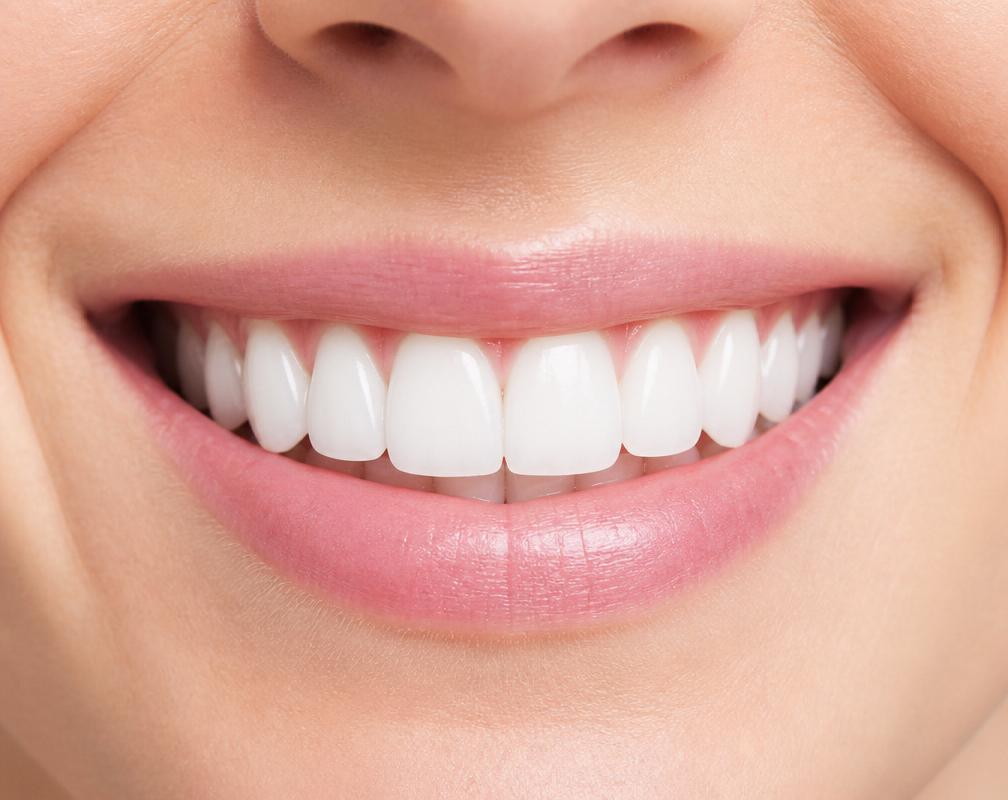 Close-up of a bright, even smile after cosmetic treatment at Riverside Dental